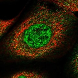 SPATA13 Antibody, Novus Biologicals 0.1mL; Unlabeled:Antibodies, Polyclonal